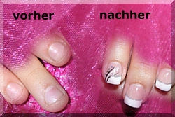 Nagelbeisser